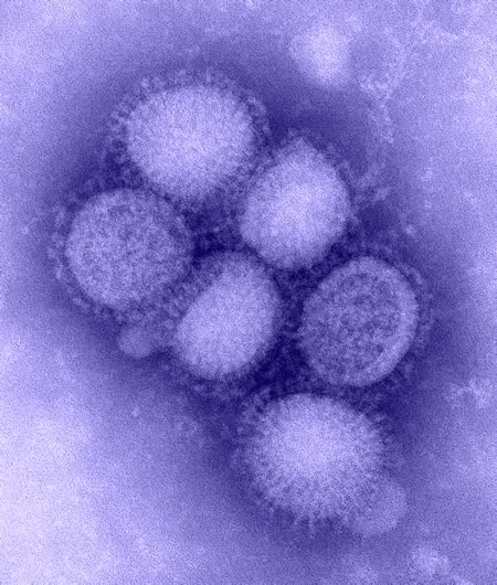 http://www.wabash.edu/images2/news/B00528_H1N1_flu_blue_med(1).jpg