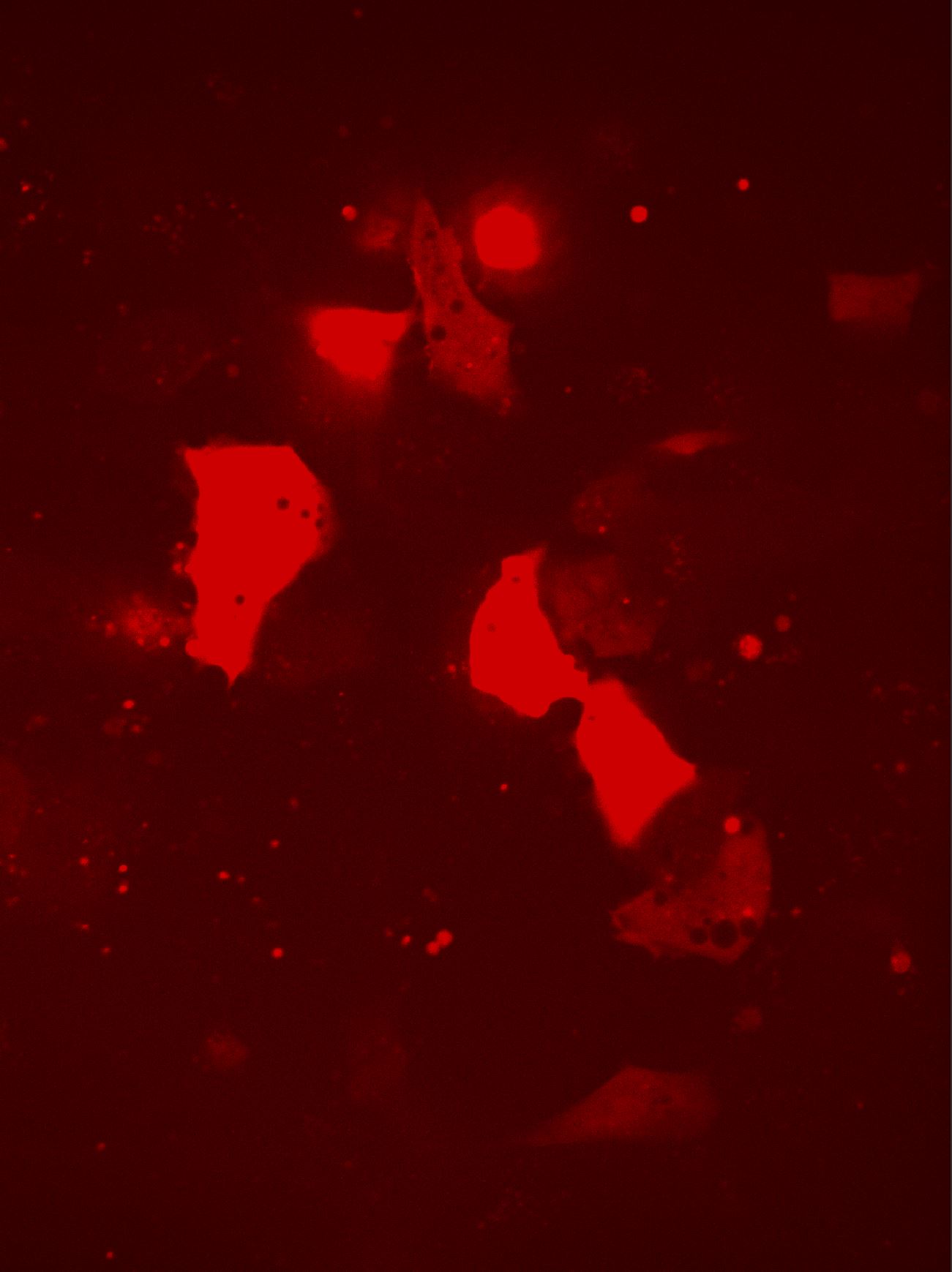 “An image of some cancerous lung cells which are expressing a specific protein (shown in red) due to a sequence of DNA that I designed and transfected into them,” Oppman explained. 